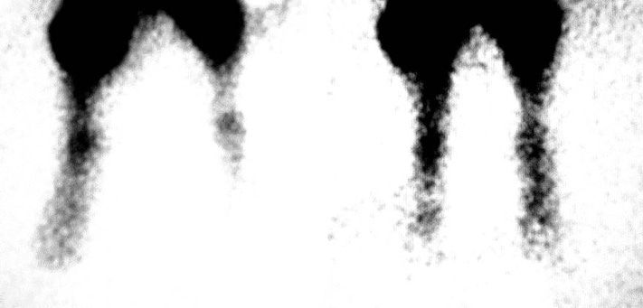 Томские новости, Томские ученые разработали установку для лечения обморожений Томские ученые разработали установку для лечения обморожений