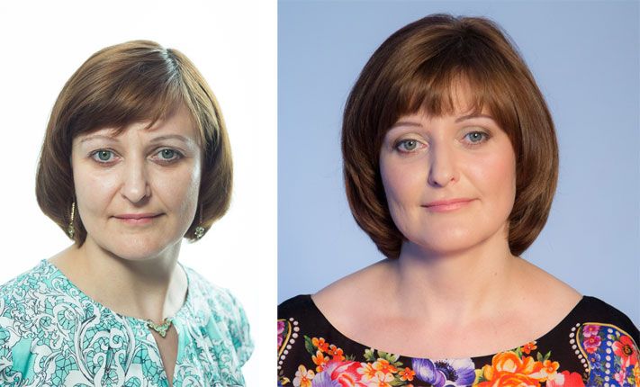 Томские новости, Инновационная косметология в Томске: Антиэйдж &mdash; красота или вечная молодость Инновационная косметология в Томске: Антиэйдж &mdash; красота или вечная молодость