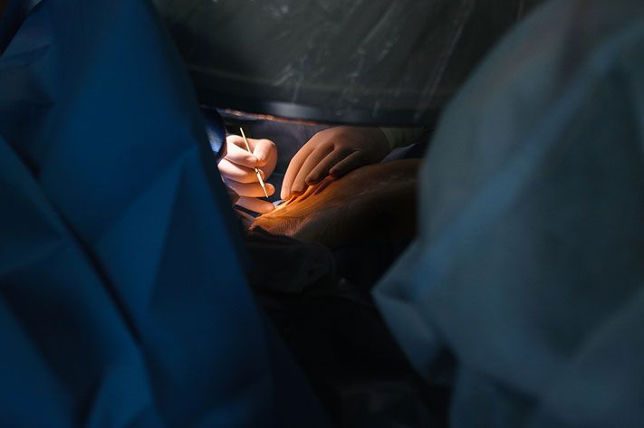 Образование и наука, Томские новости, Томские ученые разработали прибор для безопасного удаления катаракты Томские ученые разработали прибор для безопасного удаления катаракты