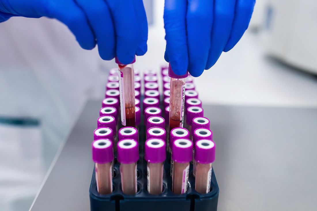 Благотворительность, Томские новости, костный мозг донор донорство рак онкология благотворительность Томичей приглашают сдать кровь и помочь детям с онкологией
