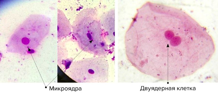 Образование и наука, Томские новости, мобильные телефоны исследование ученые наука образование вредны ли мобильные телефоны сотовые Мобильные телефоны влияют на строение клеток человеческих щёк - томские ученые