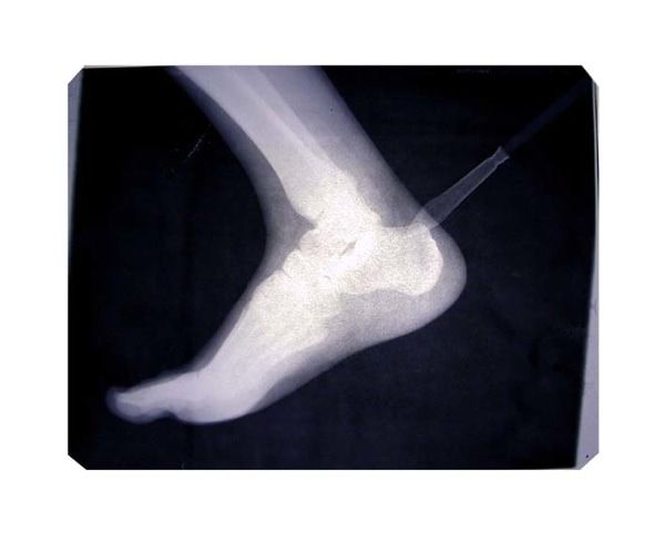 Культура в Томске, Томские новости, выставка современное искусство ГЦСИ рентген Слонов Выставка рентгенограмм открывается в Томске