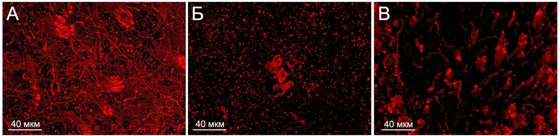 Образование и наука, ТГУ, Томские новости, инсульт развитие болезни лечение проблему сосудами головного мозга Томские ученые впервые смогли «вживую» увидеть, как мозг восстанавливается после инсульта