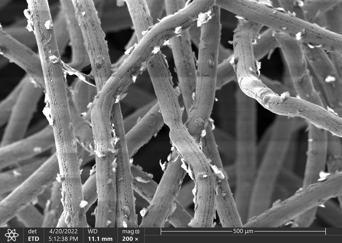 Образование и наука, ТГУ, Томские новости, ТГУ образование вуз новые материалы биомедицина импланты томские новости интересные Томские ученые создали гиперупругие материалы для имплантов