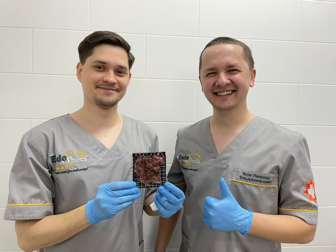 Медицина и здоровье, Томские новости, диспансер опухоль аденома удаление онкология Томские медики 10 часов удаляли 7-сантиметровую опухоль у пожилой томички