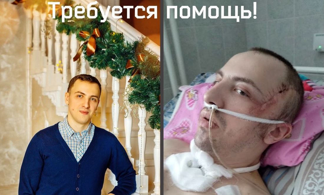 Благотворительность, Томские новости, Митя Селюнин помощь сбор средств разбился спасти жизнь В Томске собирают средства пострадавшему в аварии