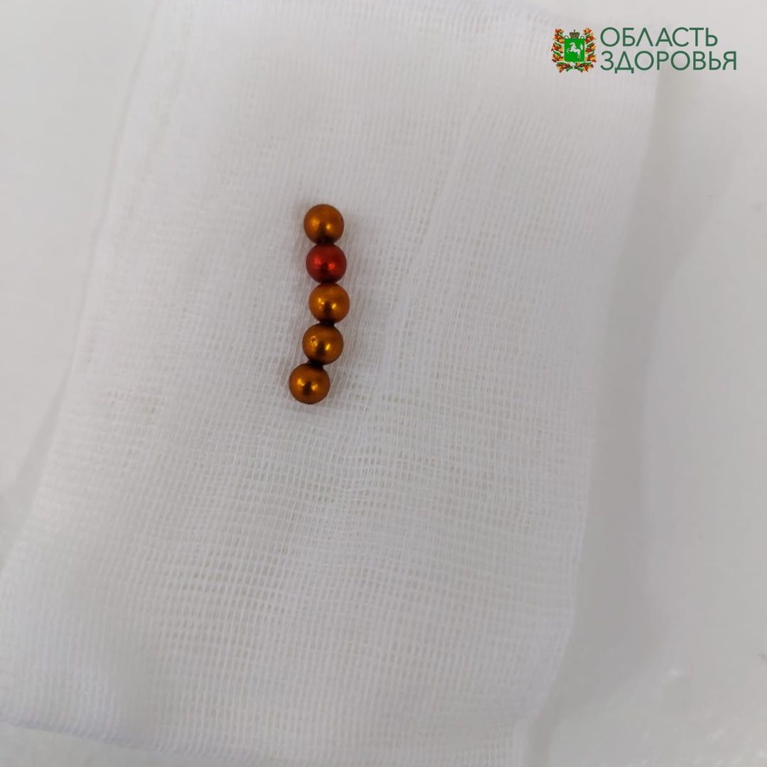 Медицина и здоровье, Томские новости, медицина магнит ребенок интересные новости Томска сводка происшествий жесть Томска ребенок проглотил Томские врачи извлекли из кишечника годовалого ребёнка 5 магнитов